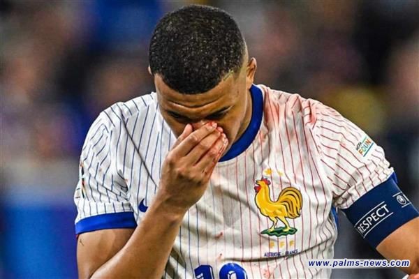 ديشامب : مبابي سيكون بحاجة لإجراء عملية جراحية في أنفه